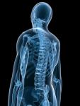 Osteoporose